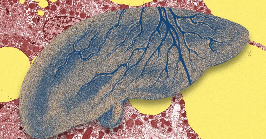 There's a Growing Fatty Liver Crisis: How AI Might Help Tackle It